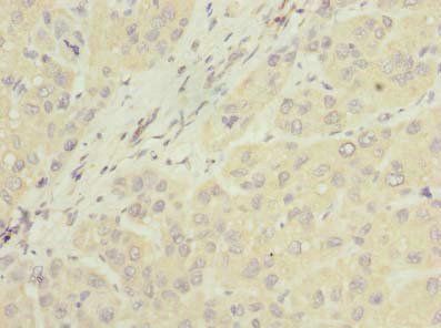 NUBPL Antibody