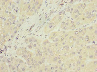 NUBPL antibody