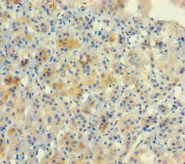 NUP153 Antibody