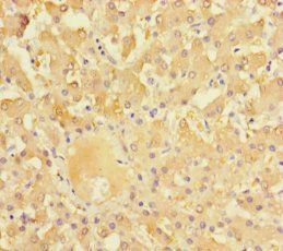 Nuclear R subfamily 1 group I member 3 antibody