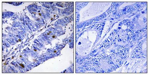 Nuclear Receptor NR4A1 (Phospho-Ser351) Antibody