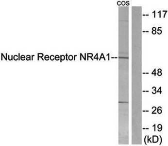 Nuclear Receptor NR4A1 (Ab-351) Antibody