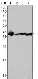 Nucleophosmin Antibody