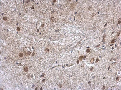 Nucleoporin p62 antibody