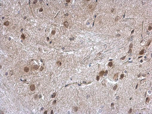 nucleoporin 62 Antibody