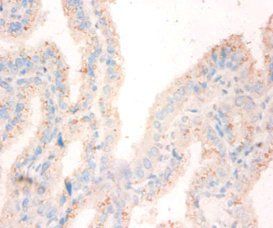 NME1 Antibody
