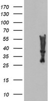 Nucleotide binding protein like Antibody