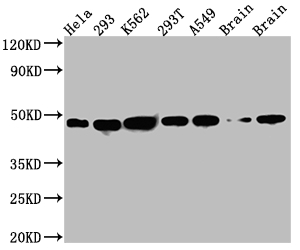 NUDC Recombinant Monoclonal Antibody