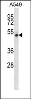 NUDCD1 antibody