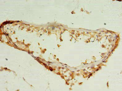 NUDT11 Antibody