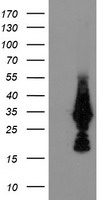 NUDT18 Antibody