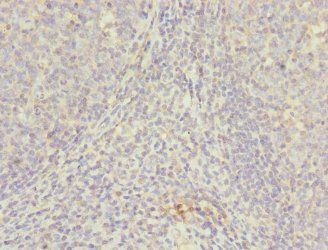 NUDT2 Antibody