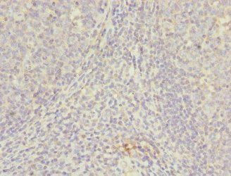 NUDT2 antibody