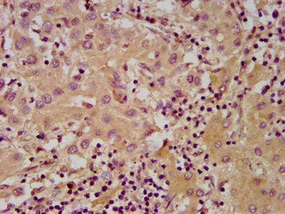 NUDT5 Antibody