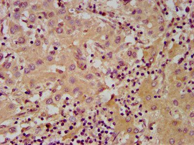 NUDT5 antibody