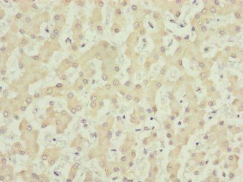 NUF2 antibody