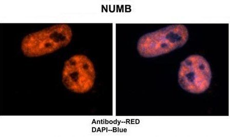 Numb antibody