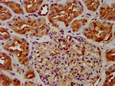 NUMBL Antibody