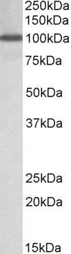 NUP107 antibody