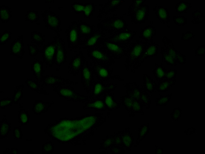 NUP153 Recombinant Monoclonal Antibody
