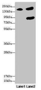 NUP155 antibody