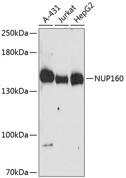 NUP160 antibody