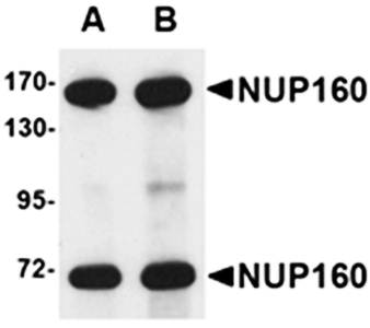 NUP160 Antibody