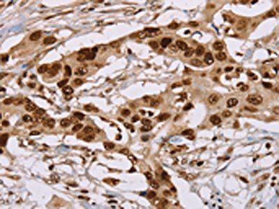 NUP50 Antibody