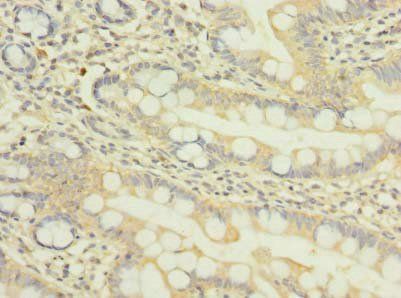 NUP58 Antibody