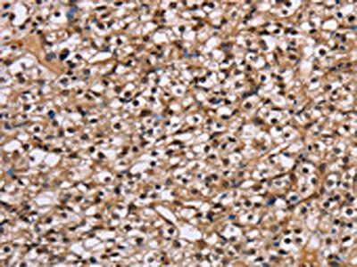NUP62 Antibody