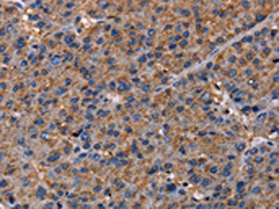 NUP62 Antibody