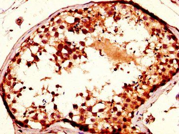 NUP93 Antibody