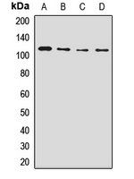 NUP98 antibody