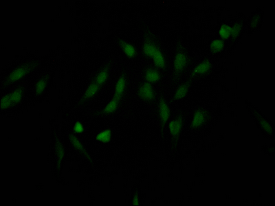 NUP98 Recombinant Monoclonal Antibody