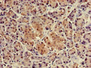 NUPR1 Antibody