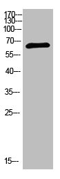 NUTM1 antibody