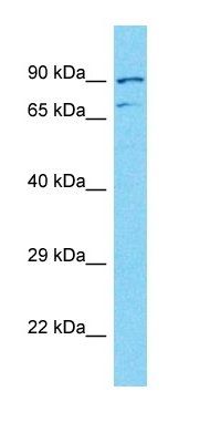 NUTM2A antibody