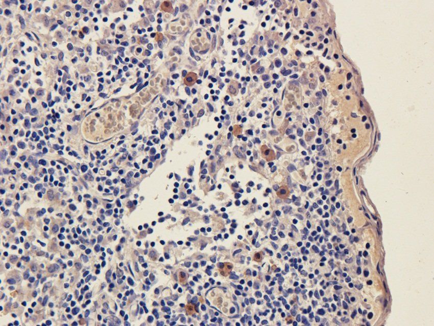 NXT2 antibody