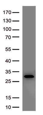 NY-ESO-1 (CTAG1B) antibody