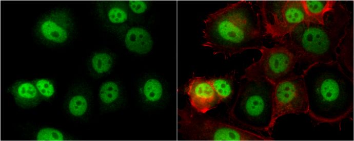 O-GlcNAc transferase antibody