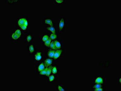 O-phosphoseryl-tRNA(Sec) selenium transferase antibody