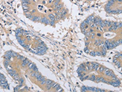 OASL Antibody