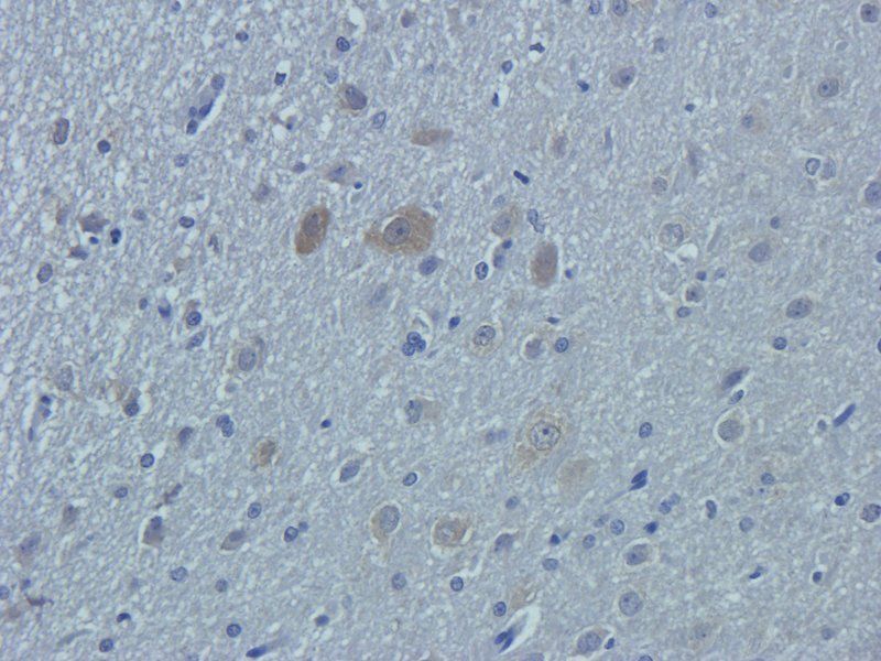 OAT3 antibody