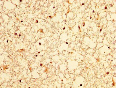 OCRL Antibody