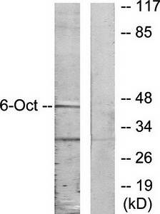 OCT6 antibody