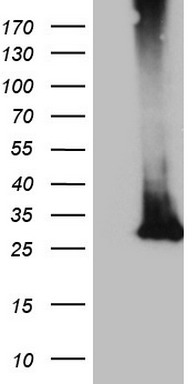 Ocular development associated gene (GATAD1) antibody
