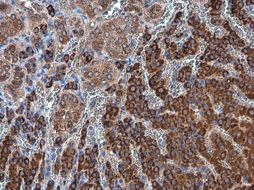 ODC antibody [N3C3]