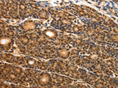 ODC1 antibody