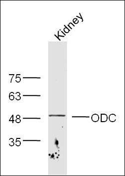 ODC antibody