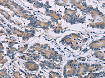ODF2 Antibody